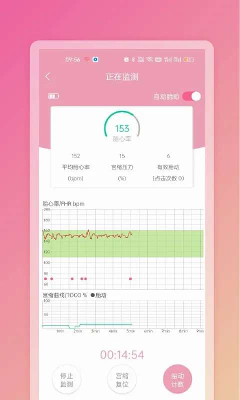 Fetaphon Home(̥�ļ໤����)v1.0.26 �ֻ����ͼ3