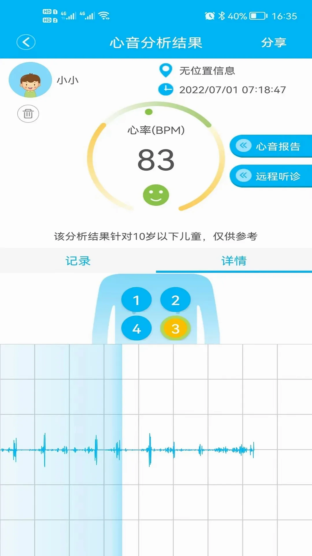 �������������ֻ���